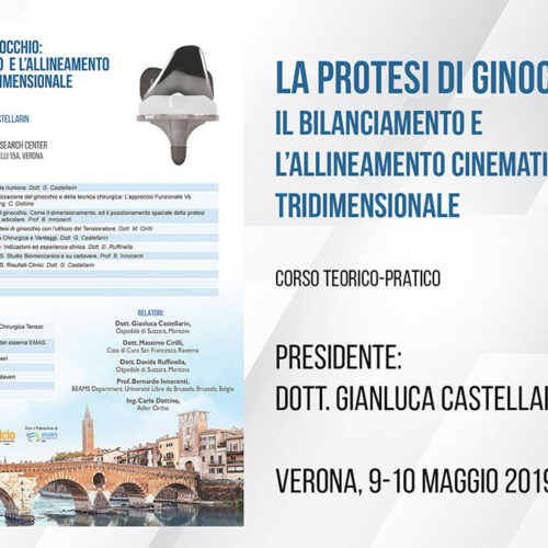 potesi_immagine_blog Protesi al ginocchio: il bilanciamento e l’allineamento cinematico tridimensionale