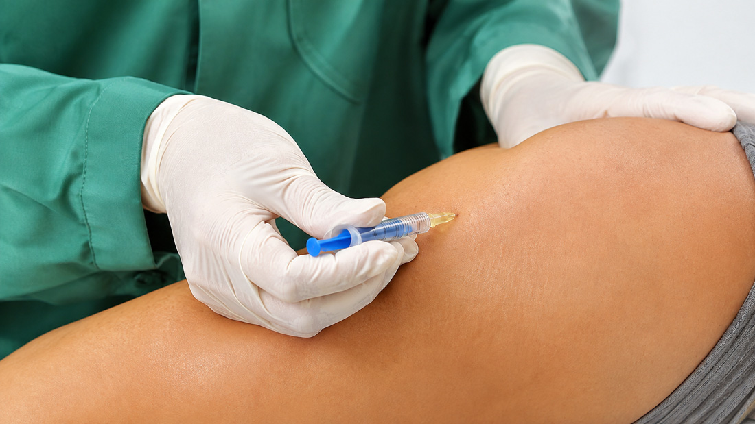Mesoterapia antalgica